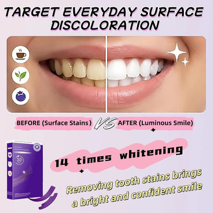 Purple Teeth Whitening Strips – 30 Minute Teeth Whitening